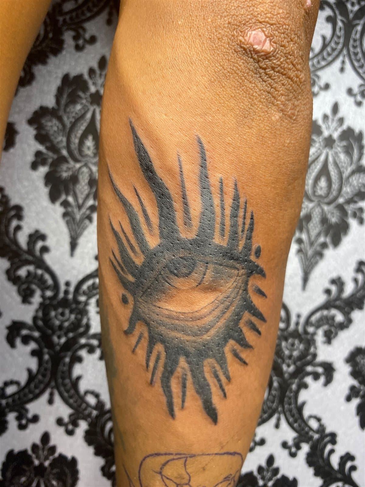 Bold sun-eye, forearm